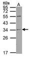 Tumor Protein P63 Regulated 1 Like antibody, PA5-34885, Invitrogen Antibodies, Western Blot image 