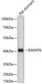 UDP-GlcNAc:BetaGal Beta-1,3-N-Acetylglucosaminyltransferase 6 antibody, GTX66316, GeneTex, Western Blot image 