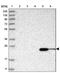 Abhydrolase Domain Containing 14B antibody, PA5-57661, Invitrogen Antibodies, Western Blot image 