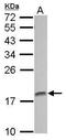 Amelogenin X-Linked antibody, GTX118869, GeneTex, Western Blot image 