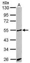 Activin A Receptor Like Type 1 antibody, GTX100035, GeneTex, Western Blot image 