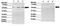 Interleukin 13 Receptor Subunit Alpha 2 antibody, GTX45500, GeneTex, Western Blot image 