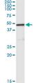 Carboxypeptidase A2 antibody, MA5-18635, Invitrogen Antibodies, Immunoprecipitation image 