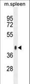 Synaptotagmin Like 3 antibody, LS-C161660, Lifespan Biosciences, Western Blot image 