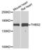 Thrombospondin 2 antibody, PA5-76418, Invitrogen Antibodies, Western Blot image 