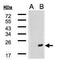 DnaJ Heat Shock Protein Family (Hsp40) Member B9 antibody, GTX104853, GeneTex, Western Blot image 