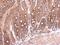 Semaphorin-4B antibody, GTX121035, GeneTex, Immunohistochemistry paraffin image 