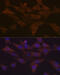 Protein Kinase C Delta antibody, GTX02829, GeneTex, Immunocytochemistry image 