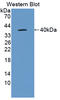 Interleukin 22 Receptor Subunit Alpha 1 antibody, LS-C374833, Lifespan Biosciences, Western Blot image 