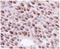 RAD51 Recombinase antibody, NB100-148, Novus Biologicals, Immunohistochemistry frozen image 