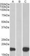 Pleckstrin homology-like domain family A member 3 antibody, 46-179, ProSci, Enzyme Linked Immunosorbent Assay image 