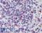 Leukotriene B4 Receptor antibody, LS-A1493, Lifespan Biosciences, Immunohistochemistry paraffin image 