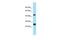 Transmembrane BAX Inhibitor Motif Containing 4 antibody, PA5-45924, Invitrogen Antibodies, Western Blot image 