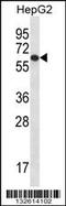 TBC1 Domain Family Member 22A antibody, 56-692, ProSci, Western Blot image 