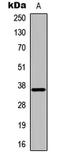 Docking Protein 5 antibody, LS-C358967, Lifespan Biosciences, Western Blot image 