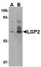 DExH-Box Helicase 58 antibody, PA5-20433, Invitrogen Antibodies, Western Blot image 