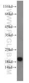 ADP Ribosylation Factor 3 antibody, 22289-1-AP, Proteintech Group, Western Blot image 