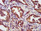 Homeodomain Interacting Protein Kinase 1 antibody, LS-C673321, Lifespan Biosciences, Immunohistochemistry paraffin image 