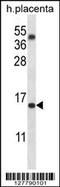 Transmembrane 4 L Six Family Member 18 antibody, MBS9212632, MyBioSource, Western Blot image 