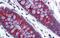 RAD18 E3 Ubiquitin Protein Ligase antibody, orb330292, Biorbyt, Immunohistochemistry paraffin image 
