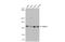 Histone Deacetylase 4 antibody, GTX110231, GeneTex, Western Blot image 