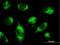 Procollagen-Lysine,2-Oxoglutarate 5-Dioxygenase 3 antibody, H00008985-B01P, Novus Biologicals, Immunofluorescence image 