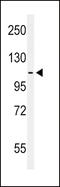 Ephrin type-A receptor 2 antibody, MBS9209771, MyBioSource, Western Blot image 