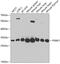 Proteasome Activator Subunit 1 antibody, GTX54593, GeneTex, Western Blot image 