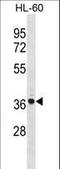 TNFAIP3 Interacting Protein 2 antibody, LS-C160082, Lifespan Biosciences, Western Blot image 