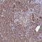 Histone PARylation Factor 1 antibody, PA5-60371, Invitrogen Antibodies, Immunohistochemistry paraffin image 