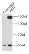 ABL Proto-Oncogene 2, Non-Receptor Tyrosine Kinase antibody, FNab00053, FineTest, Immunoprecipitation image 