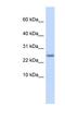 CST9 antibody, NBP1-80538, Novus Biologicals, Western Blot image 