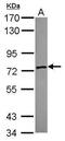 Zinc Finger SWIM-Type Containing 2 antibody, PA5-31308, Invitrogen Antibodies, Western Blot image 