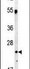 Complement C1q A Chain antibody, PA5-14208, Invitrogen Antibodies, Western Blot image 