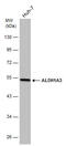 Aldehyde Dehydrogenase 1 Family Member A3 antibody, GTX633822, GeneTex, Western Blot image 