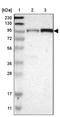 Sad1 And UNC84 Domain Containing 1 antibody, PA5-52548, Invitrogen Antibodies, Western Blot image 