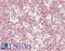 ETS Variant 6 antibody, LS-B14708, Lifespan Biosciences, Immunohistochemistry paraffin image 