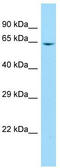 Beta-1,4 N-acetylgalactosaminyltransferase 2 antibody, TA333466, Origene, Western Blot image 