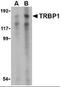 TAR (HIV-1) RNA Binding Protein 1 antibody, orb86793, Biorbyt, Western Blot image 