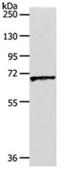 Solute Carrier Family 22 Member 3 antibody, orb107605, Biorbyt, Western Blot image 