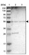 Major Facilitator Superfamily Domain Containing 13A antibody, PA5-53707, Invitrogen Antibodies, Western Blot image 