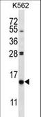 Phosphoinositide-3-Kinase Interacting Protein 1 antibody, LS-C163728, Lifespan Biosciences, Western Blot image 