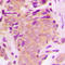 Mitogen-Activated Protein Kinase Kinase Kinase 7 antibody, LS-C368415, Lifespan Biosciences, Immunohistochemistry paraffin image 