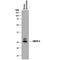 CD99 Molecule Like 2 antibody, PA5-48066, Invitrogen Antibodies, Western Blot image 