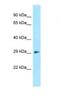 DnaJ Heat Shock Protein Family (Hsp40) Member C27 antibody, NBP1-98571, Novus Biologicals, Western Blot image 