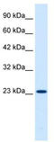 Potassium Voltage-Gated Channel Interacting Protein 2 antibody, TA338771, Origene, Western Blot image 