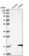 LYR Motif Containing 4 antibody, PA5-56448, Invitrogen Antibodies, Western Blot image 