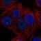 Zinc Finger Protein 778 antibody, PA5-62542, Invitrogen Antibodies, Immunofluorescence image 