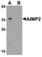 Aminoacyl TRNA Synthetase Complex Interacting Multifunctional Protein 2 antibody, TA326670, Origene, Western Blot image 