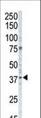 Casein Kinase 1 Alpha 1 antibody, LS-C100596, Lifespan Biosciences, Western Blot image 